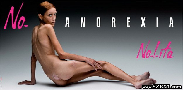 Elhunyt a 28 éves, anorexiás modell